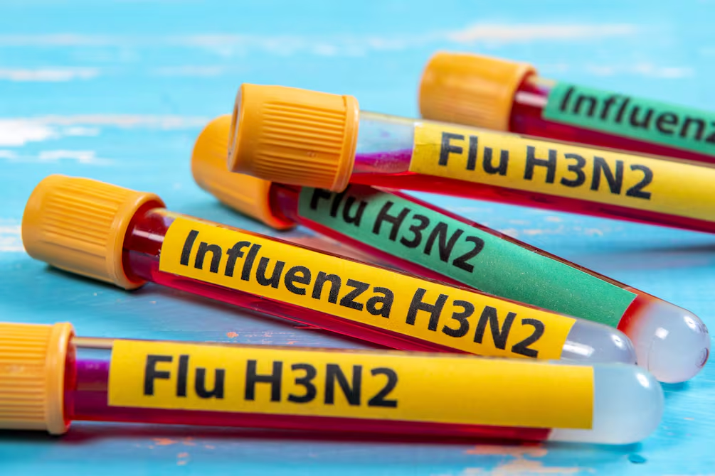 ¿Qué precauciones tomar ante el brote de la influenza A H3N2?