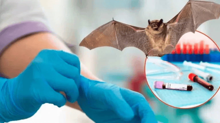 Lo que debes saber sobre el virus de Nipah